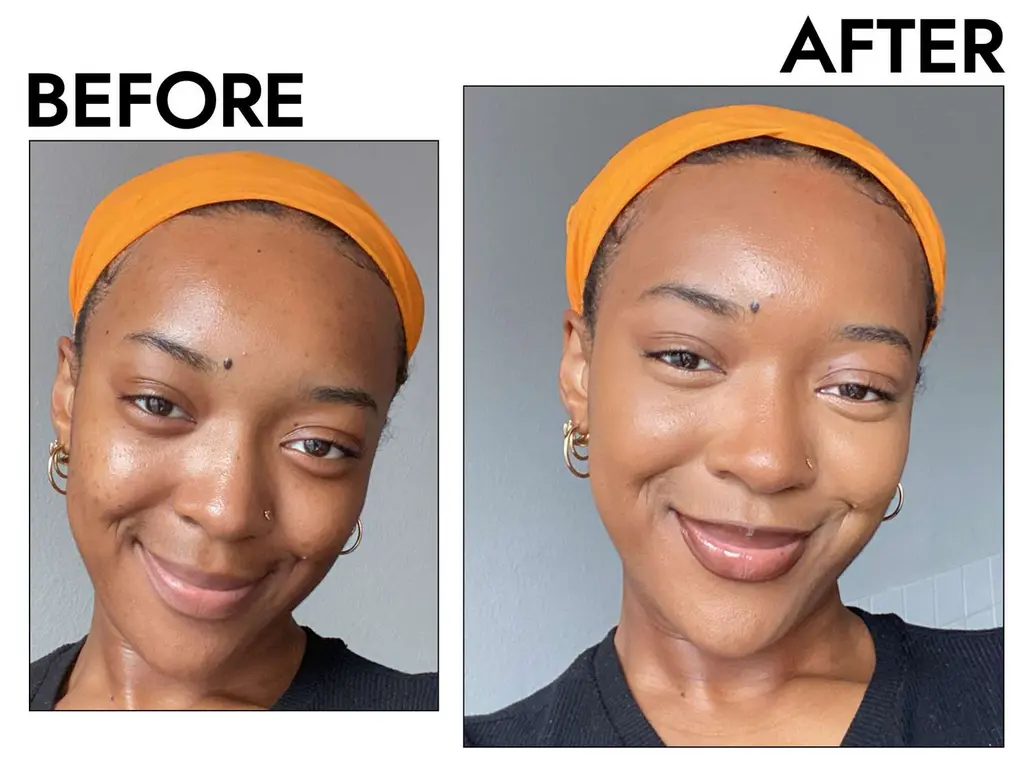 Serum application before and after