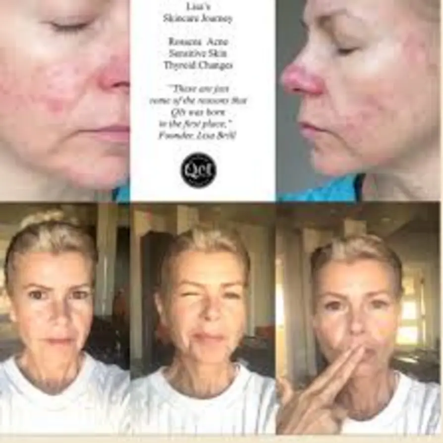 Before and after images showing skin transformation and improved complexion with top-rated SkinStore favorites from Dermstore’s 2025 skincare selection.